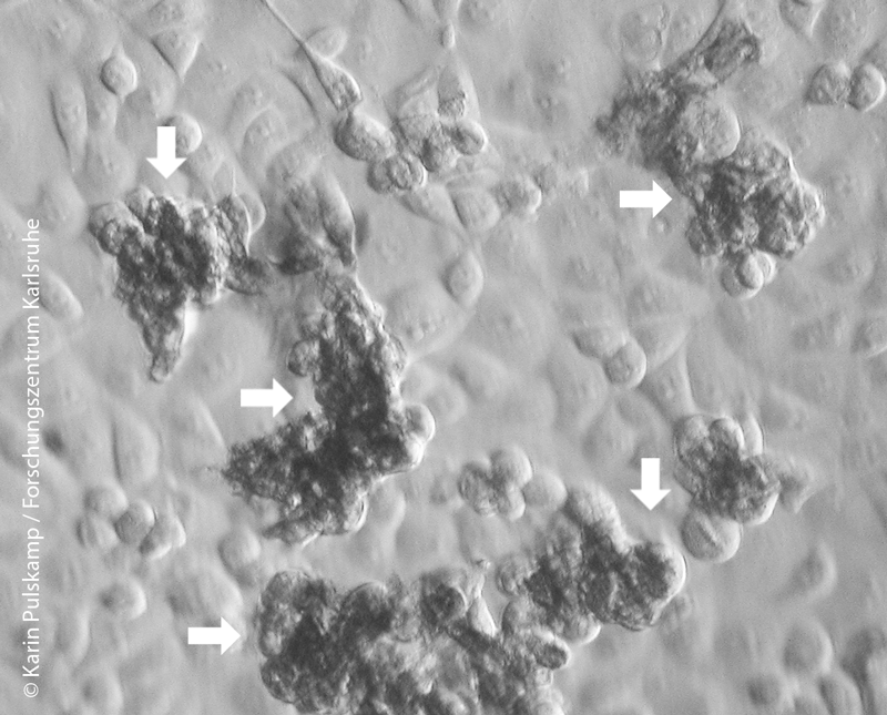Hellfeld-Bild von A549-Zellen, die mit einwandigen Kohlenstoff-Nanoröhrchen (SWCNTs, markiert mit weißen Pfeilen) behandelt wurden. 