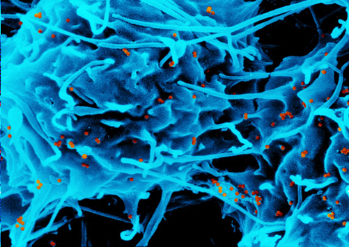 Makrophage gefüllt mit Eisenoxid-Nanopartikeln (rot)© KIT